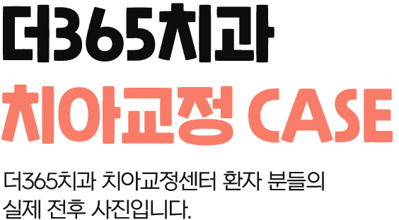 치아교정케이스