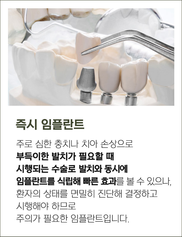 즉시 임플란트
